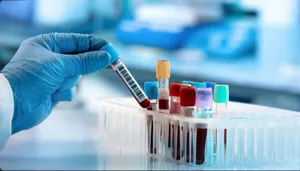 راه‌اندازی آزمایشات غربالگری سلامت جنین و بهره‌برداری از دستگاه HPLC در آزمایشگاه مرکزی استان