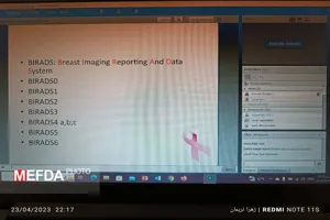 برگزاری وبینار ماموگرافی و تفسیر آن