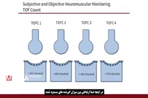 کارگاه مانیتورینگ عصبی عضلانی/ سری دوم مدرسه دانشجوی توانمند/ فصل نورولوژی برگزار شد
