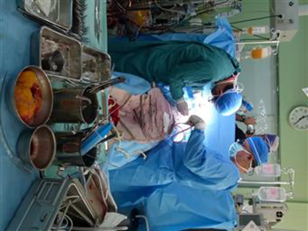 در امتداد عمل پیوندهای قلب