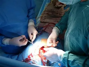 بیست و سومین قلب با دستان شفابخش تیم پیوند تپید.