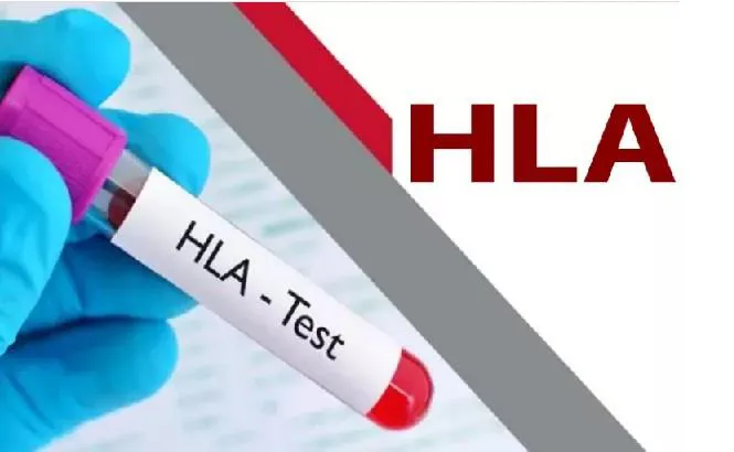 راه اندازی مجدد بخش HLA تایپینگ در مرکز امام رضا(ع) تبریز