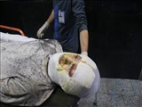 جان باختن یک نفر و مصدومیت ۵۰۸ نفر در حوادث چهارشنبه آخر سال آذربایجان شرقی